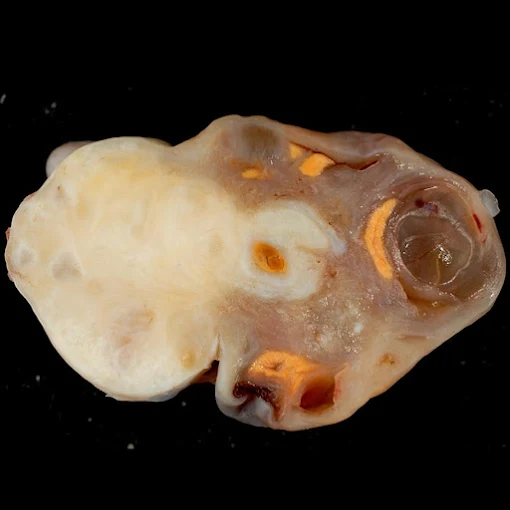Centre Ibn Rochd - Laboratoire d'Anatomie Pathologique 15